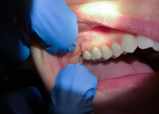 Best Weekend Emergency Dentist in Westwego, LA