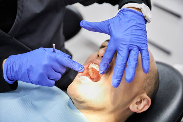 Best Emergency Dental Care for Broken or Chipped Teeth in Westwego, LA