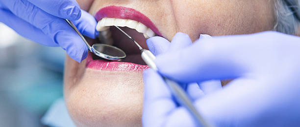 Best Emergency Wisdom Teeth Removal in Westwego, LA